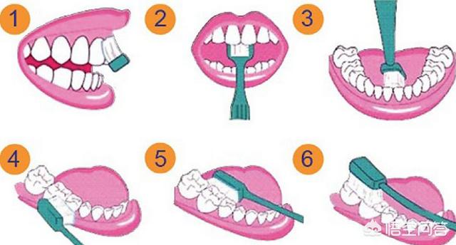超声波牙刷和电动牙刷区别（声波牙刷和电动牙刷区别）-第2张图片